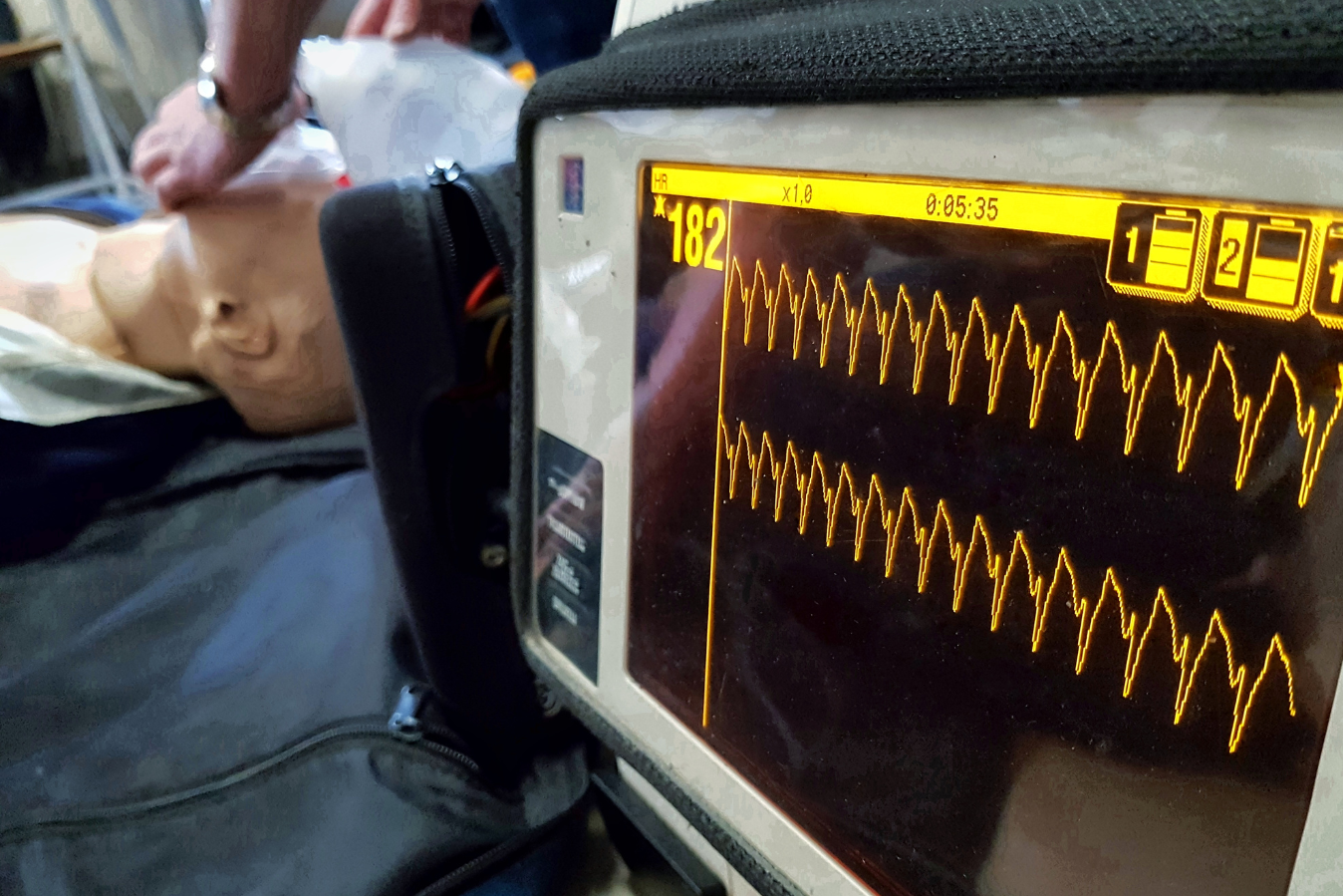 A monitor shows the number 182 on the screen