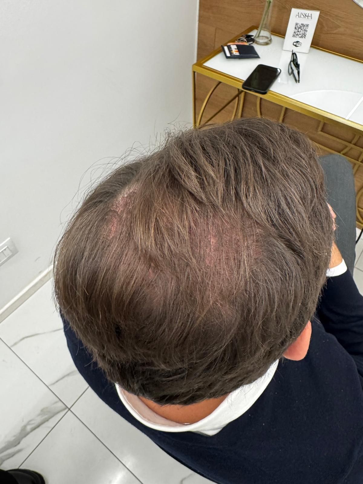 Servizi di tricologia