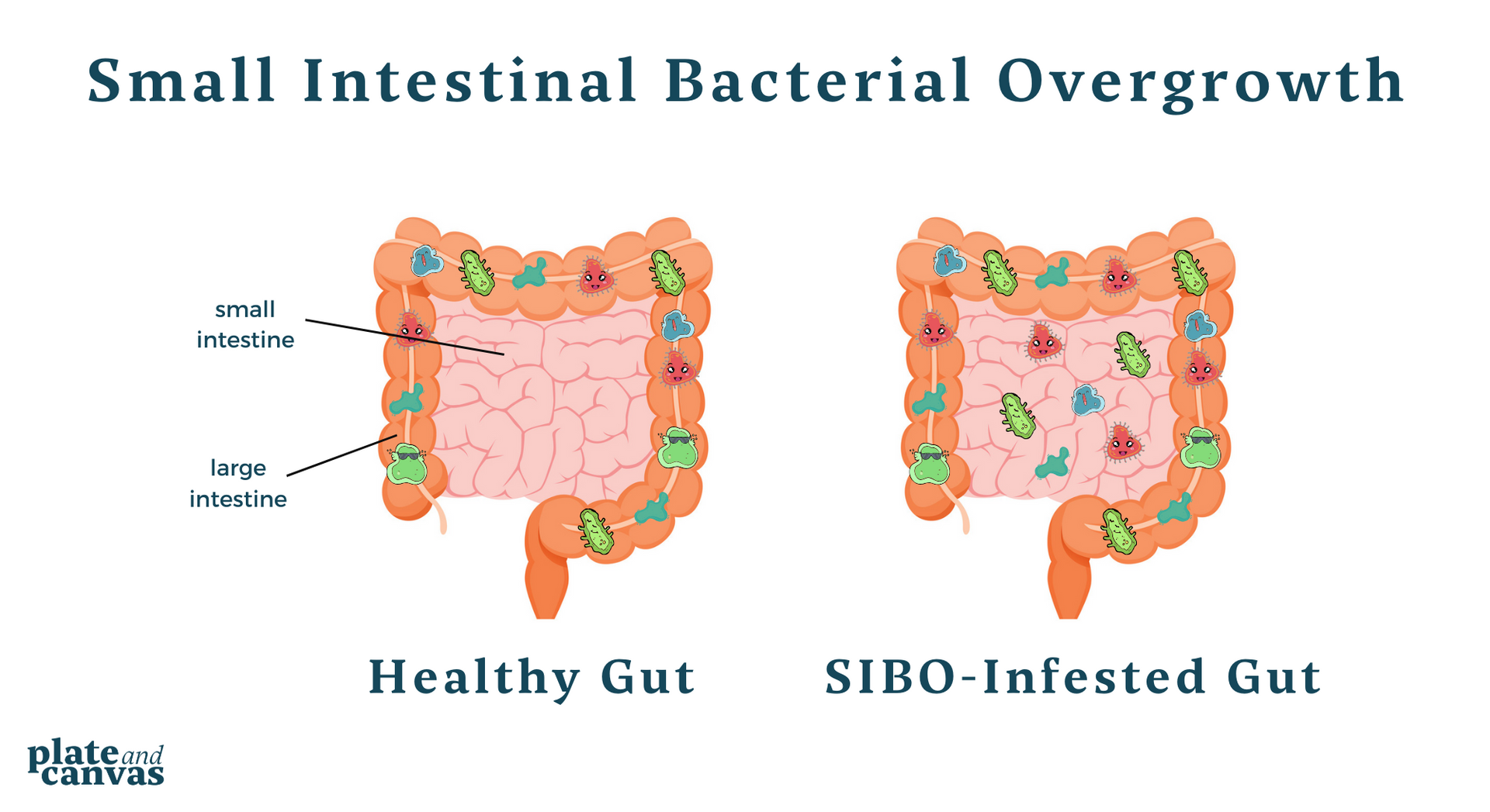 small intestinal bacterial overgrowth
