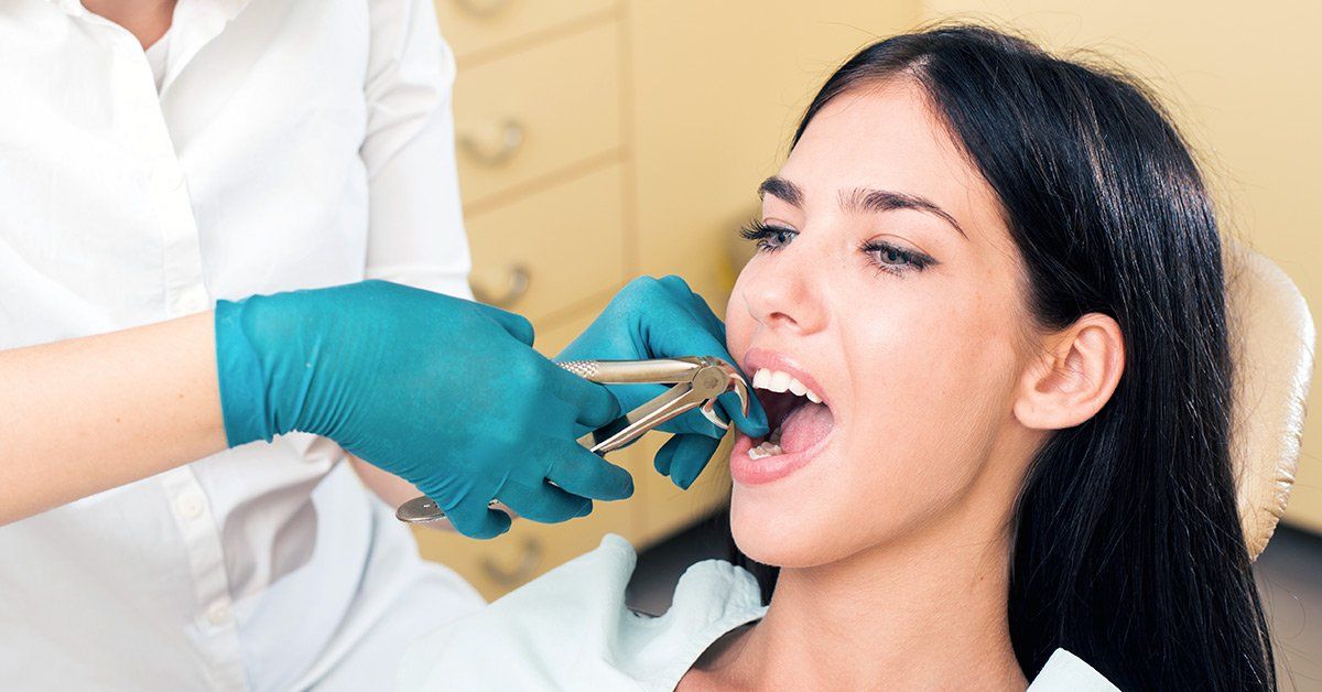 tooth extraction services