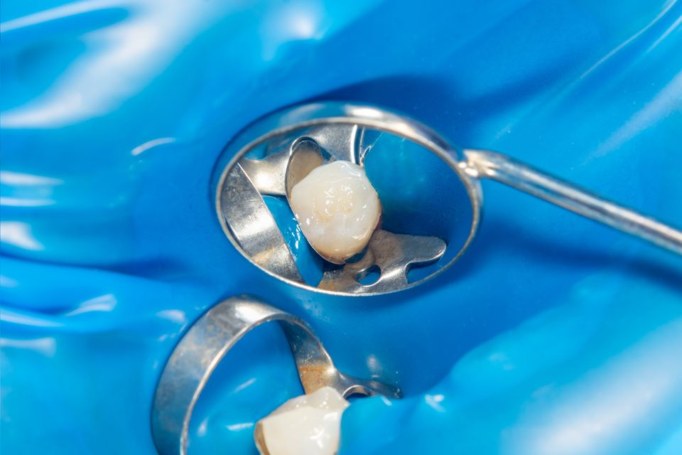 Tooth isolated with dental dam and metal instruments. Blue background.
