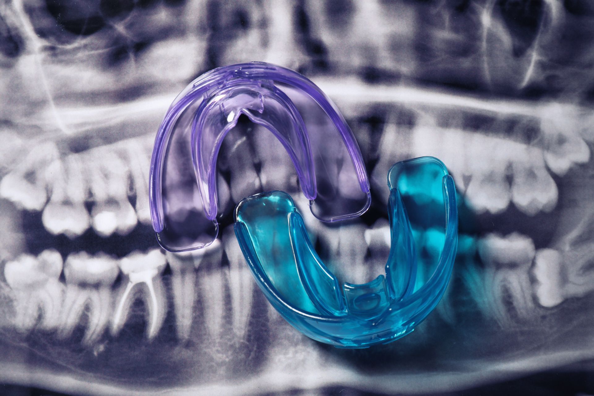 Two dental retainers, purple and blue, superimposed on a panoramic dental X-ray.