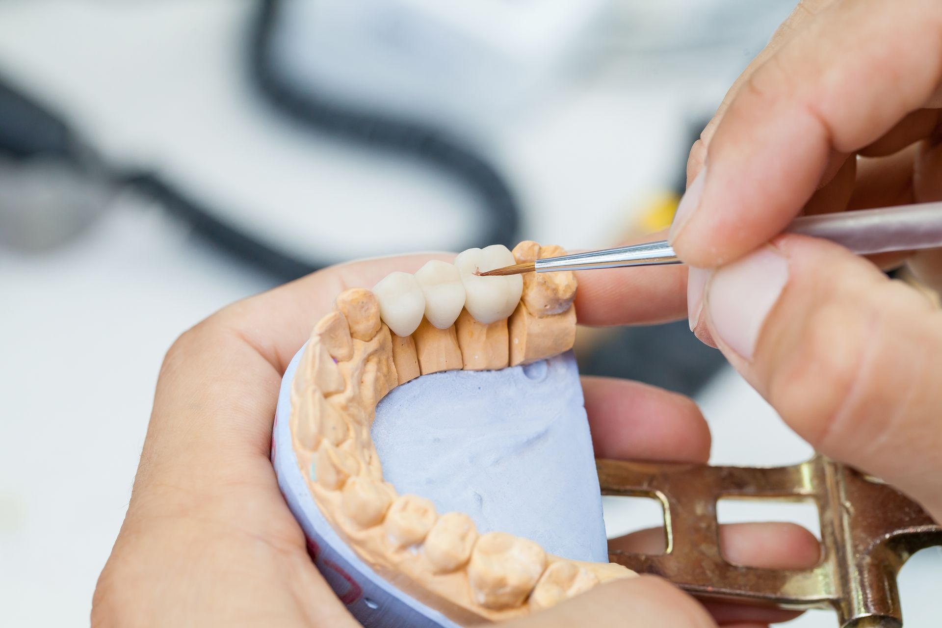Hands working on a dental model with a small tool, adjusting the placement of artificial teeth.