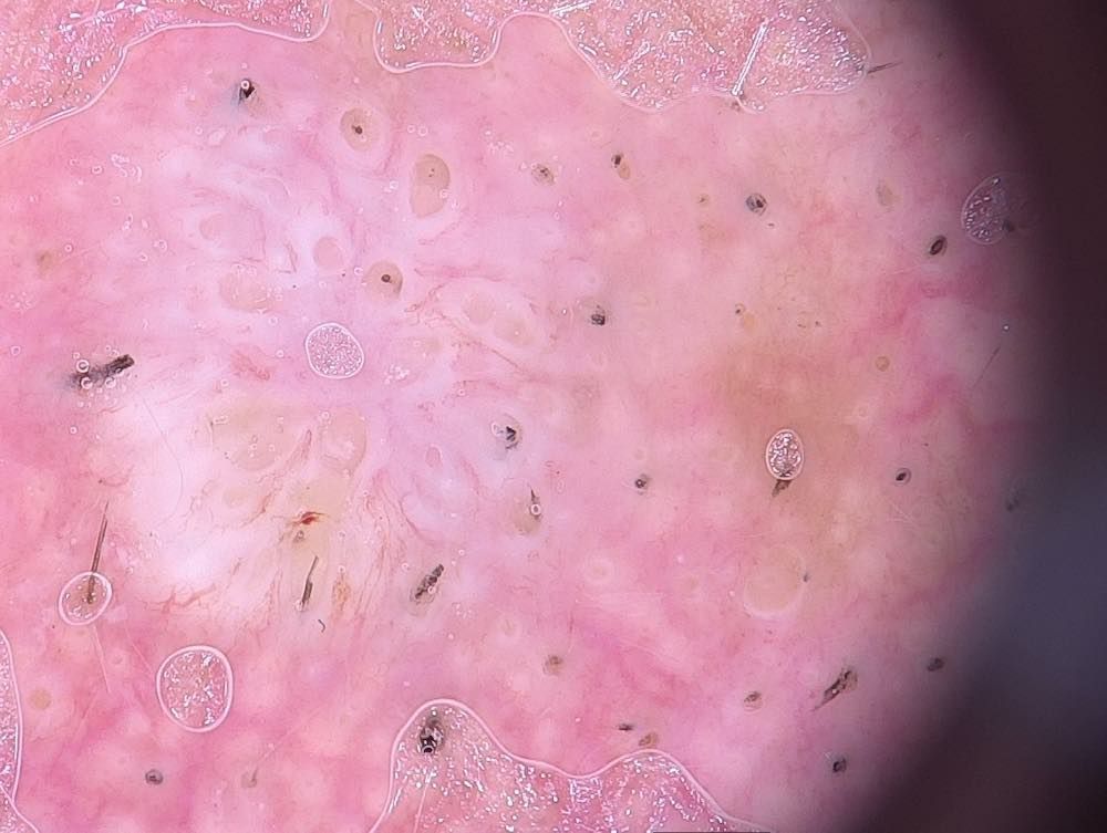 A close up of a person's skin under a microscope.