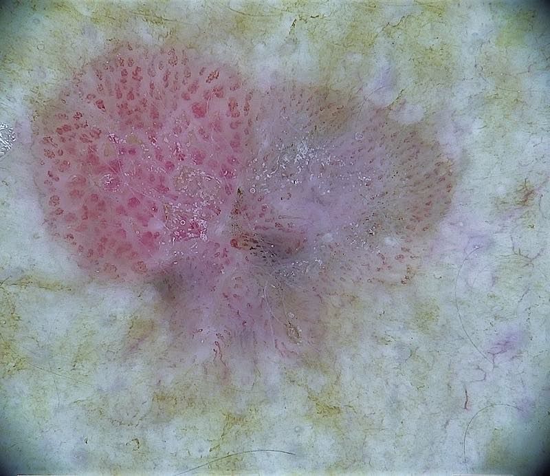 A close up of a pink spot on a white surface