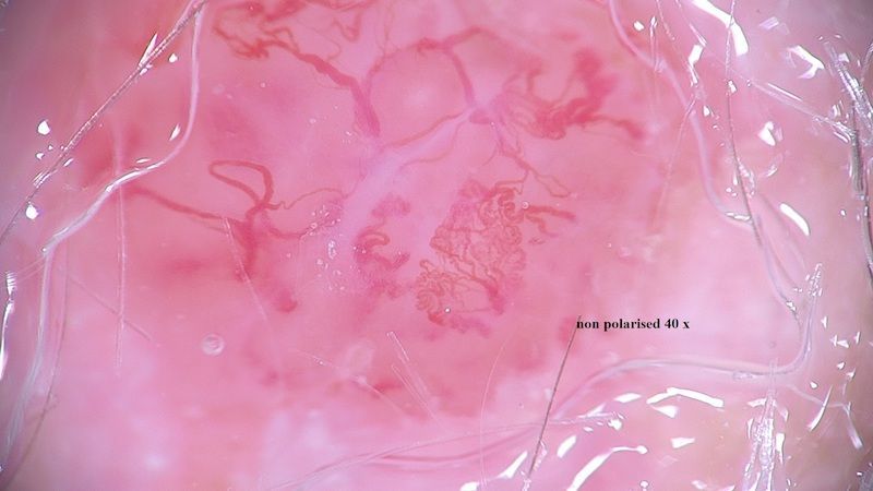 A close up of a pink tissue under a microscope.