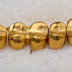 Picture Of Dental Gold— Jewelers in Ewing,NJ
