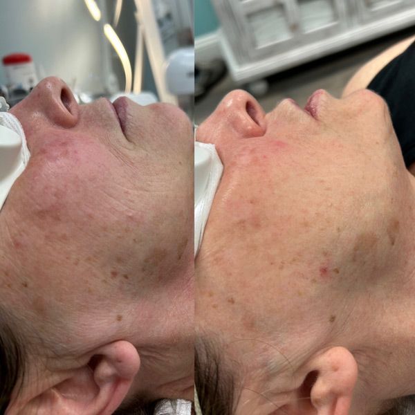 A before and after photo of a woman 's face