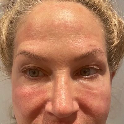 A close up of a woman 's forehead and eyes.