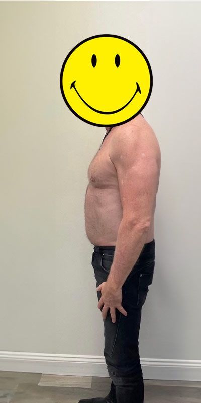 A shirtless man with a smiley face on his head.