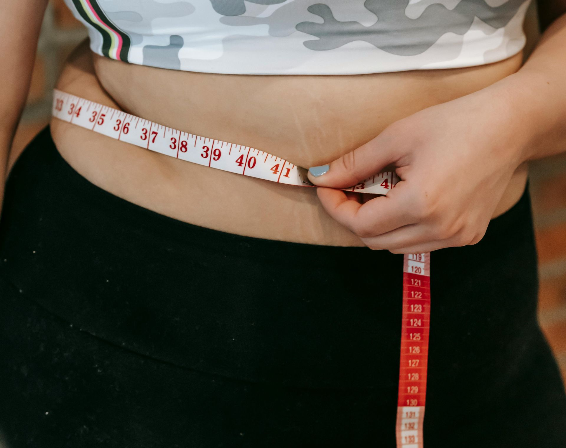 medical weight loss results from Med spa in Miami lakes