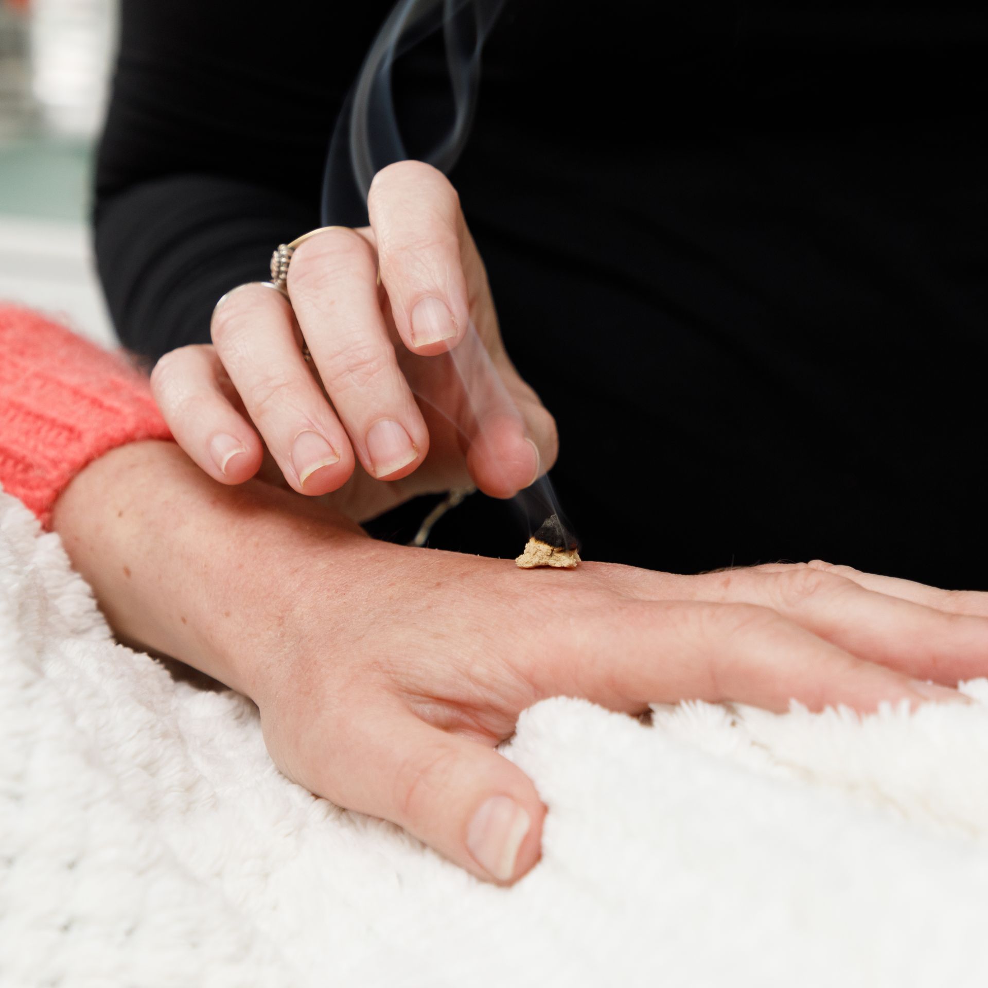 A hand receiving moxibustion treatment, smoke rising from a burning herb.