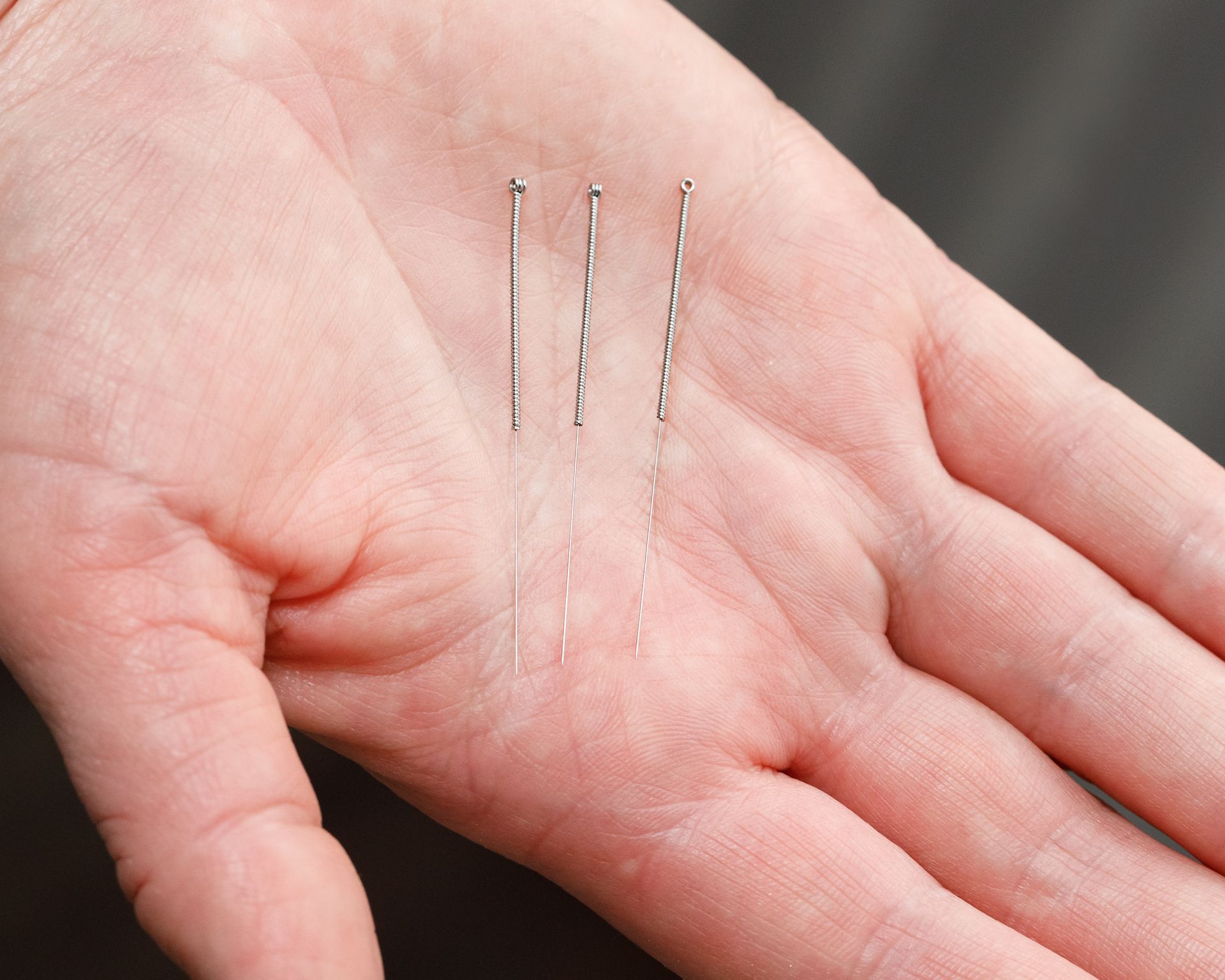 Hand holding three thin, metal acupuncture needles.