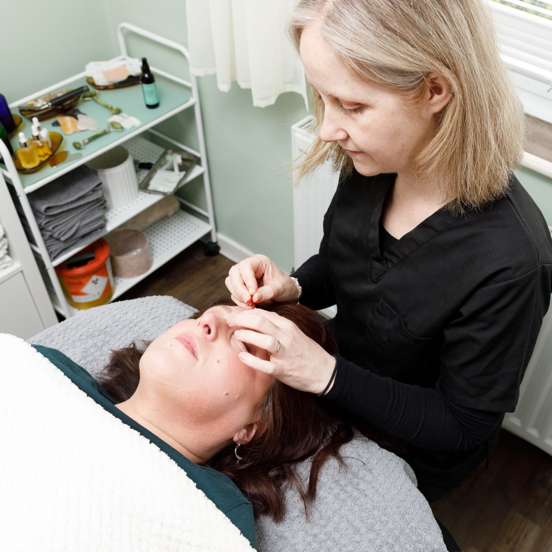 Woman receiving facial acupuncture treatment in a spa-like setting.