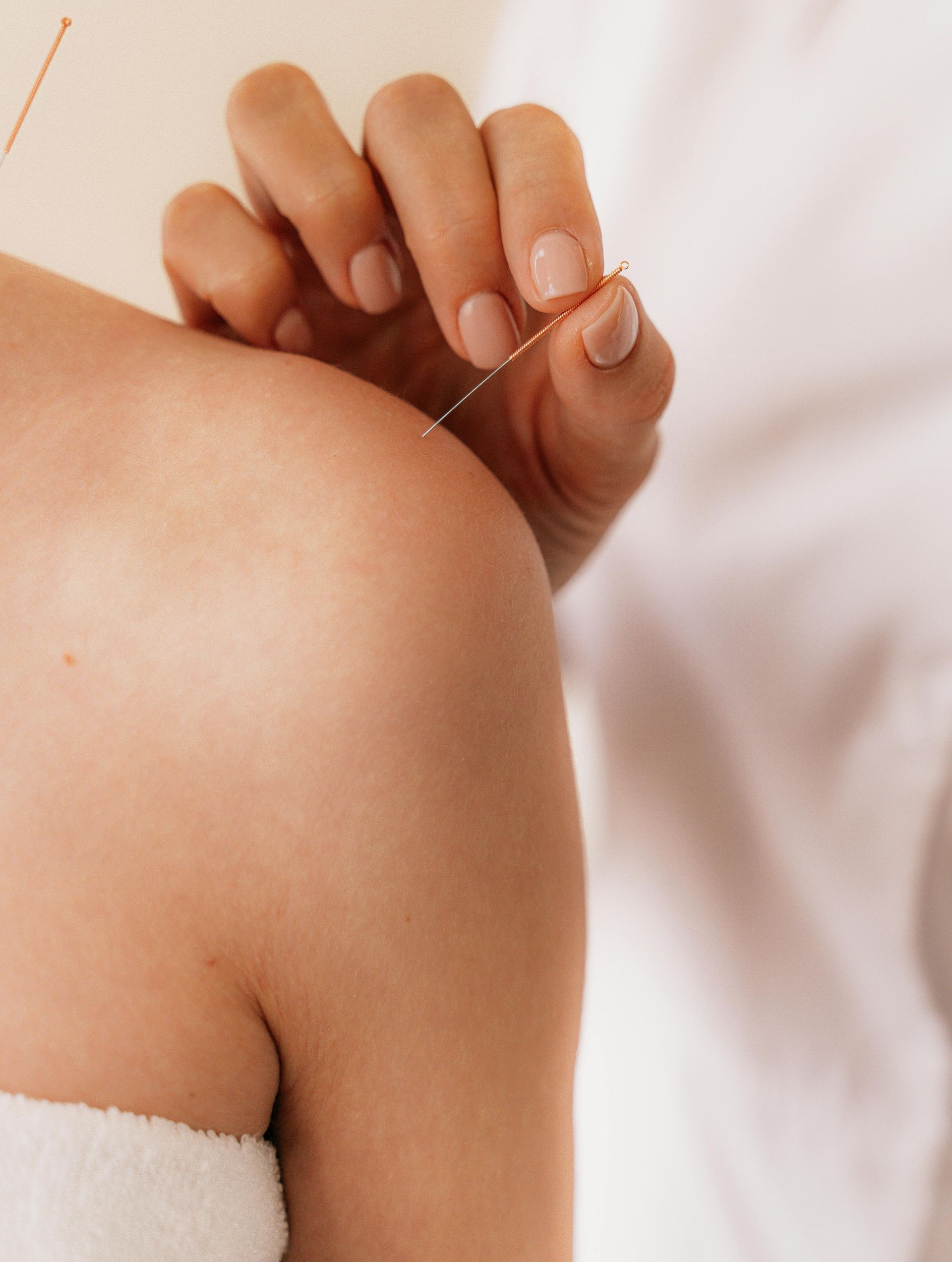 Acupuncturist inserting needle into patient's shoulder. Hand holding the needle.