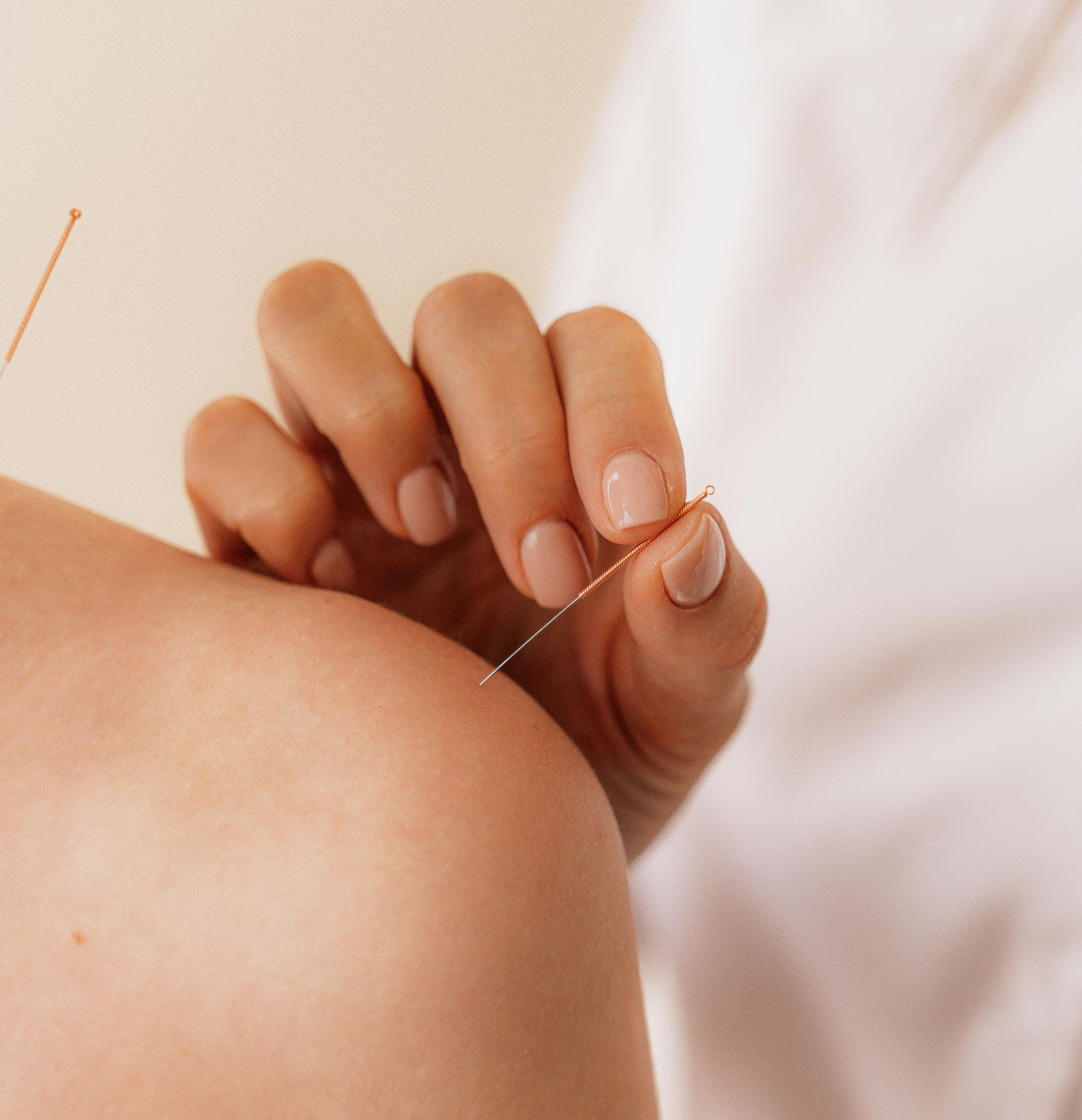 Person receiving acupuncture in their shoulder; a hand holds a needle.