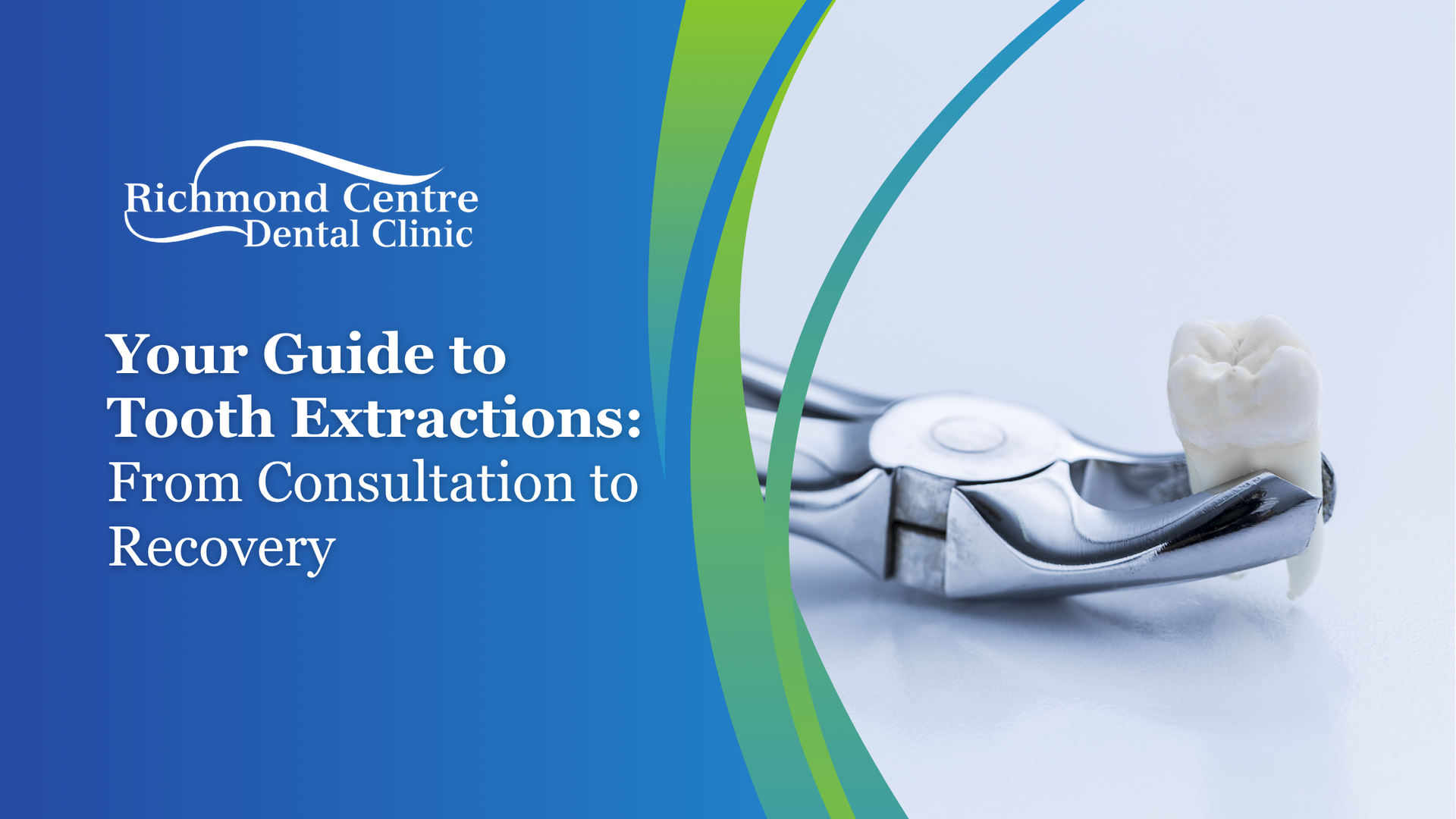 A guide to tooth extractions from consultation to recovery