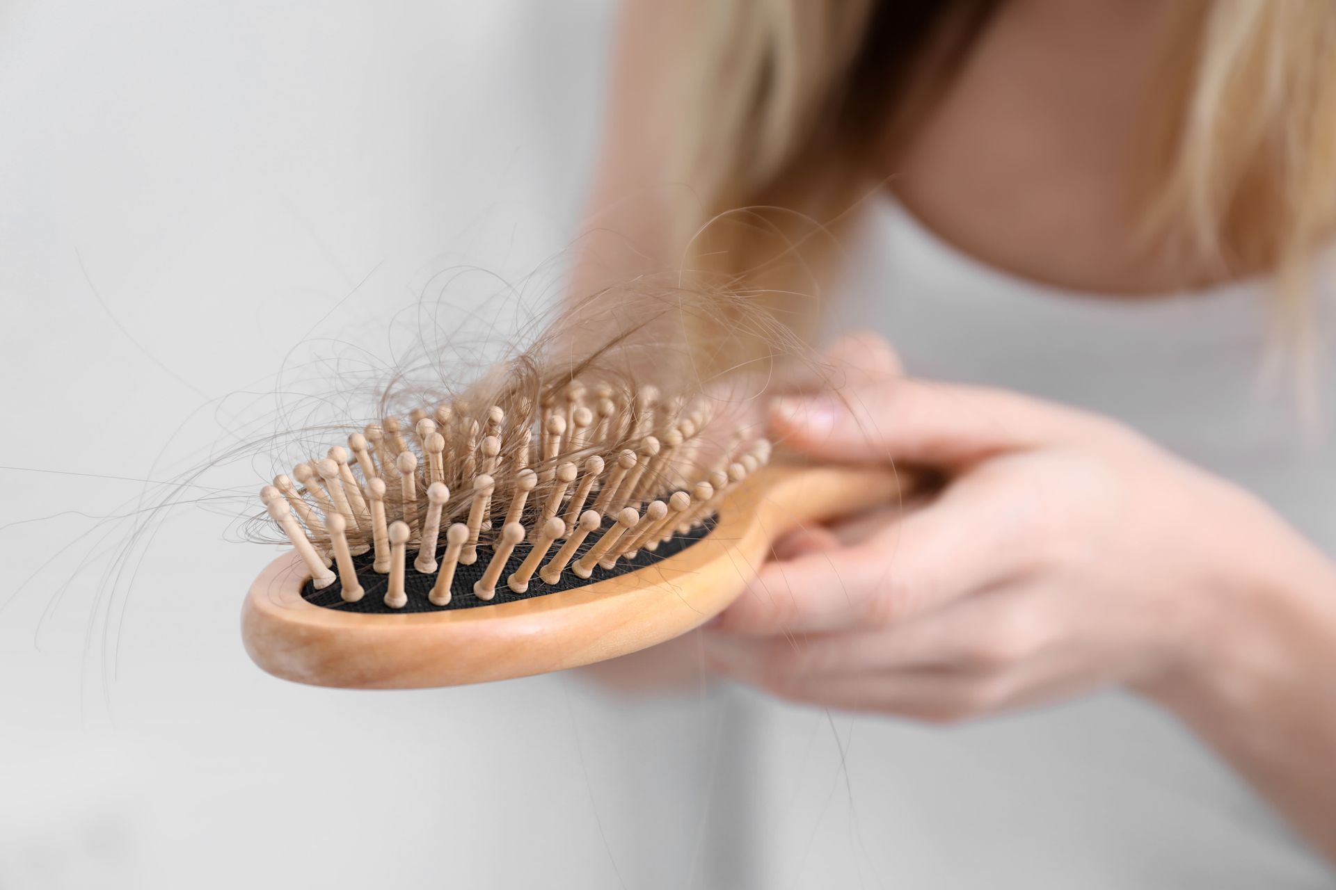 Queda de Cabelo e Rarefação Capilar