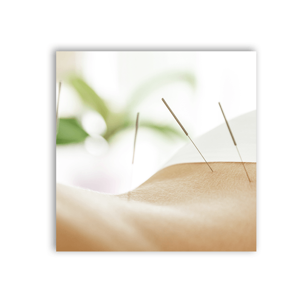 Acupuncture | Just Enjoy Life - Smithtown, NY