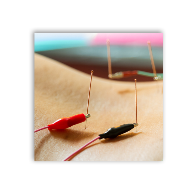 Electro Acupuncture | Just Enjoy Life - Smithtown, NY