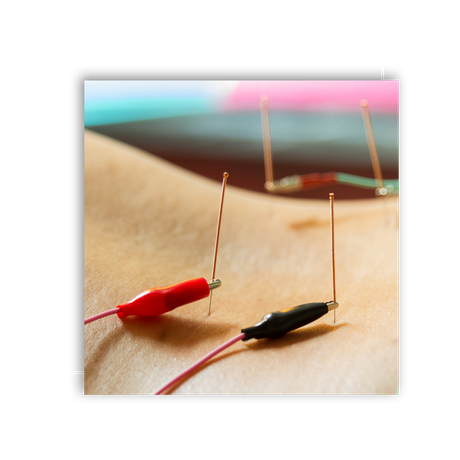 Electro Acupuncture | Just Enjoy Life - Smithtown, NY