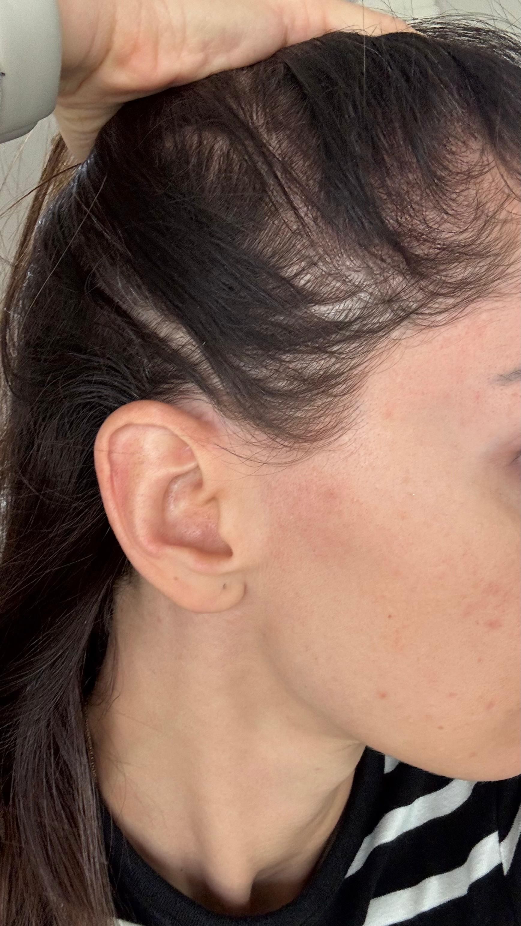 Kopf und Gesicht einer Frau; dunkles, seitlich gescheiteltes Haar, zurückweichender Haaransatz sichtbar.