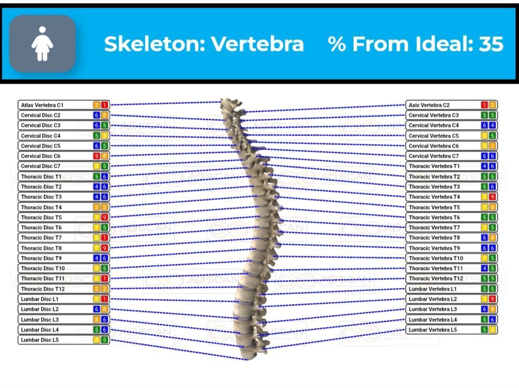Diagram of a spine with color-coded data visualizations, labeled