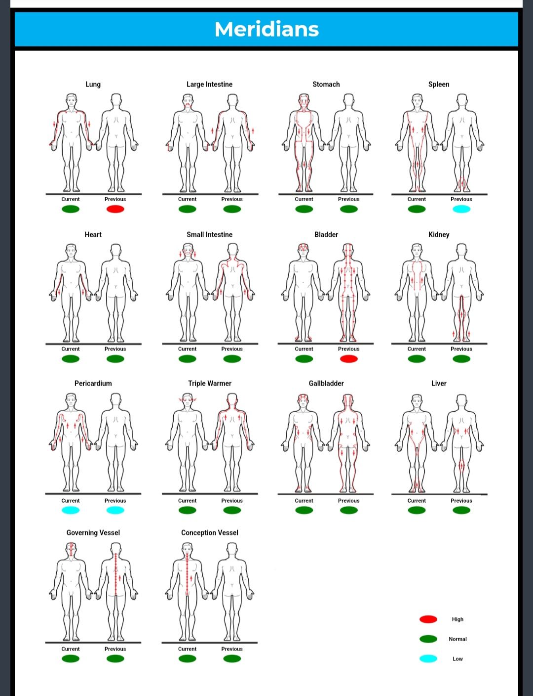 Diagram of human meridians showing pathways on body silhouettes, color-coded by organ and meridian name.