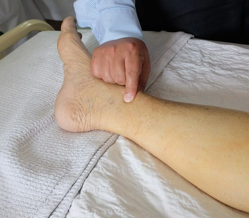 A Person's Foot and Ankle Being Examined by a Finger on a Hospital Bed — Ballina Home Healthcare Sales & Hire and Compression Stockings Plus in Ballina, NSW