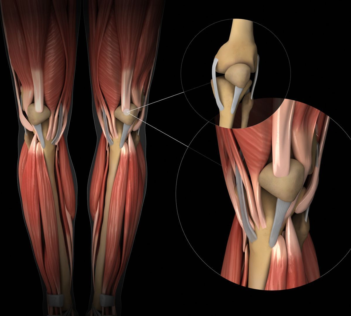 Knee Patella (Lateral Release Suregry)