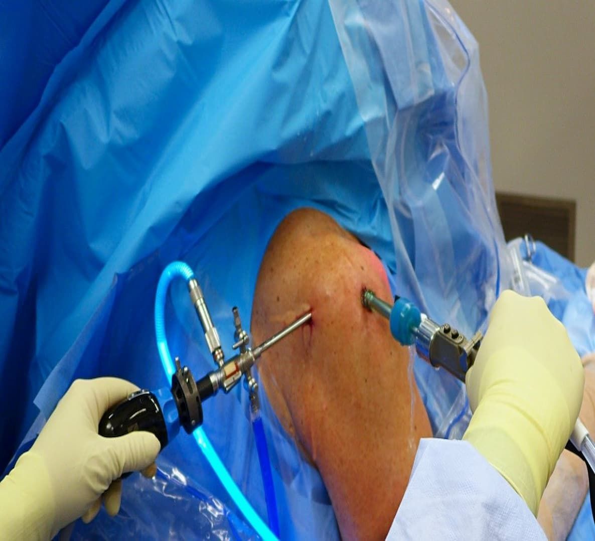 Arthroscopic labral repair