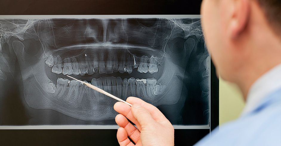Dentista señalando una radiografía dental que muestra los dientes, hablando sobre la salud bucal de un paciente.