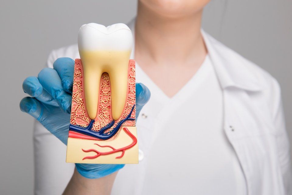 Interventi di endodonzia