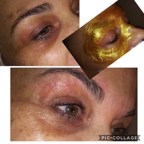 trattamento contorno occhi