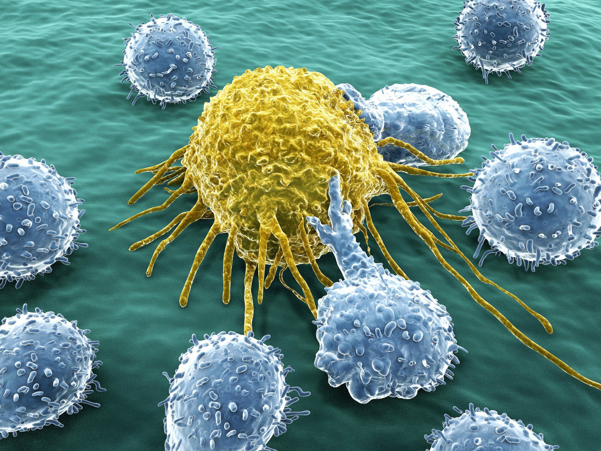 免疫細胞療法運用於癌症