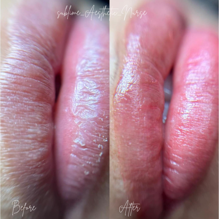 lip blush cosmetic tattoo silverdale