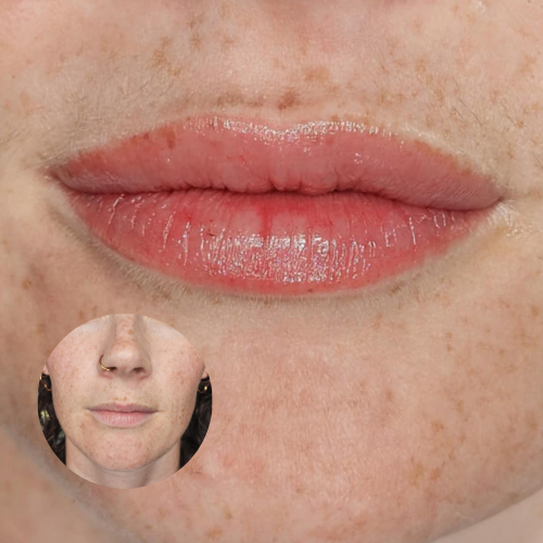 lip blush semi-permanent tattoo Auckland