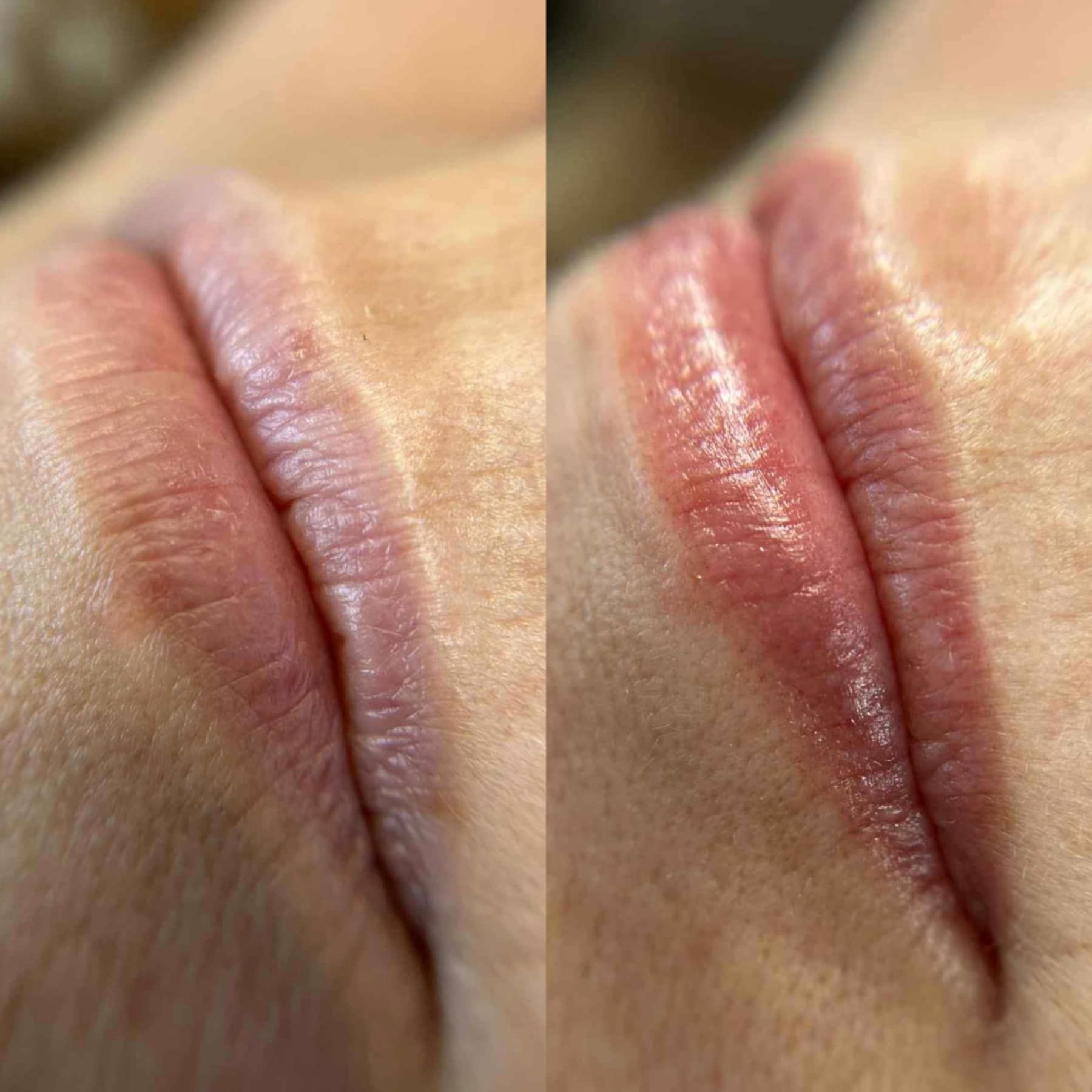 Healed lip blush result in Silverdale clinic