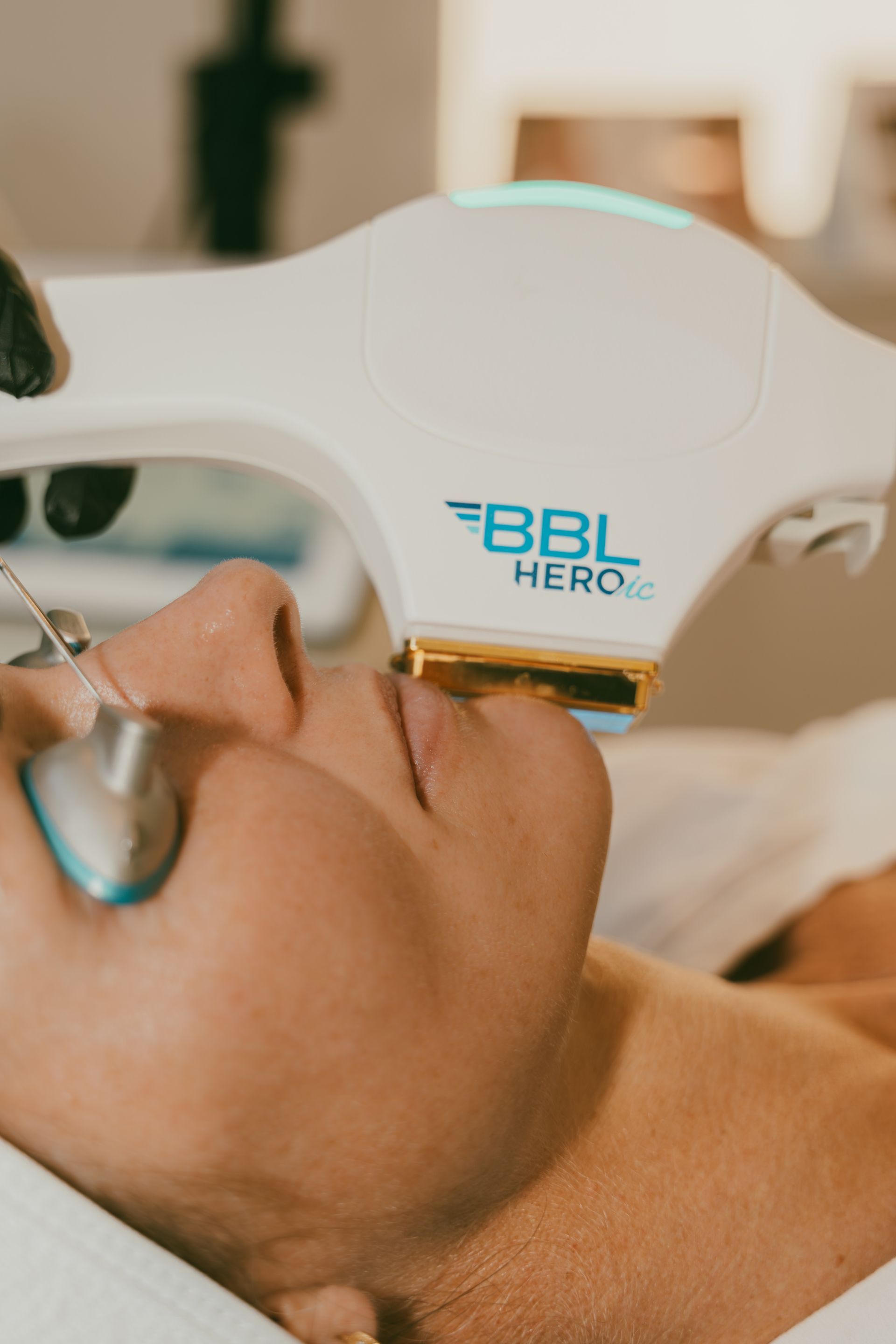 Woman receiving a BBL Hero laser treatment on her face. She's wearing protective eyewear. The setting appears to be a clinic.