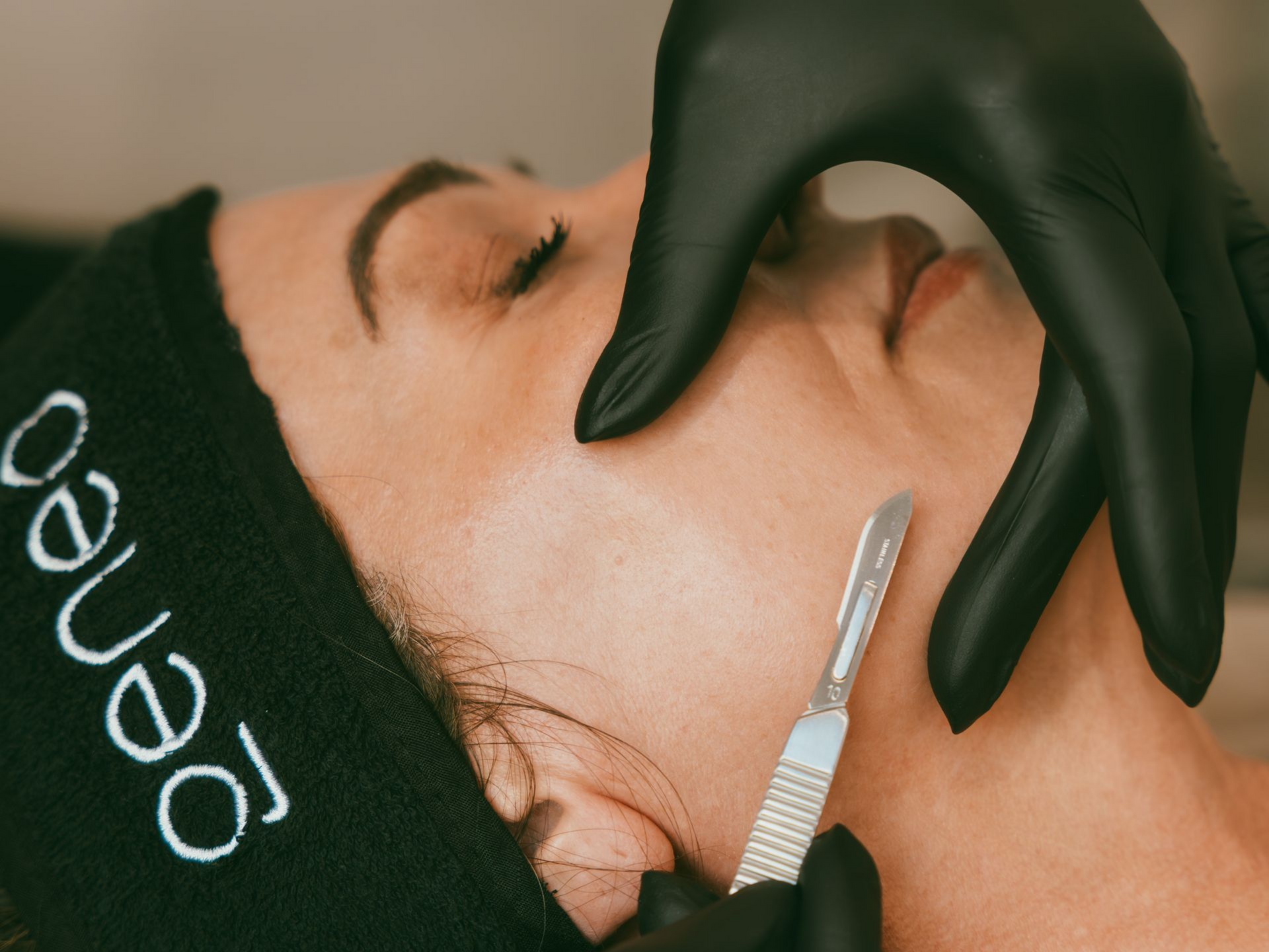 Person receiving facial dermaplaning. Black gloves hold a blade near cheek.