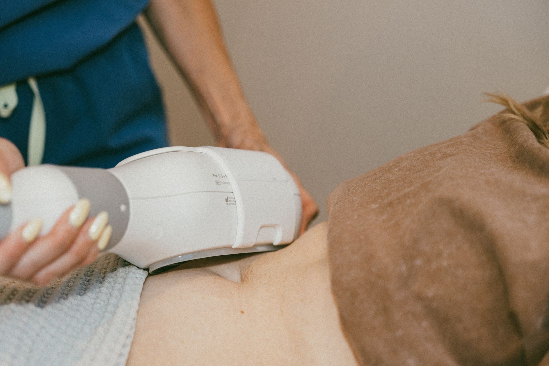Person receiving body sculpting treatment on their abdomen. A technician in a blue scrubs operates a white device.