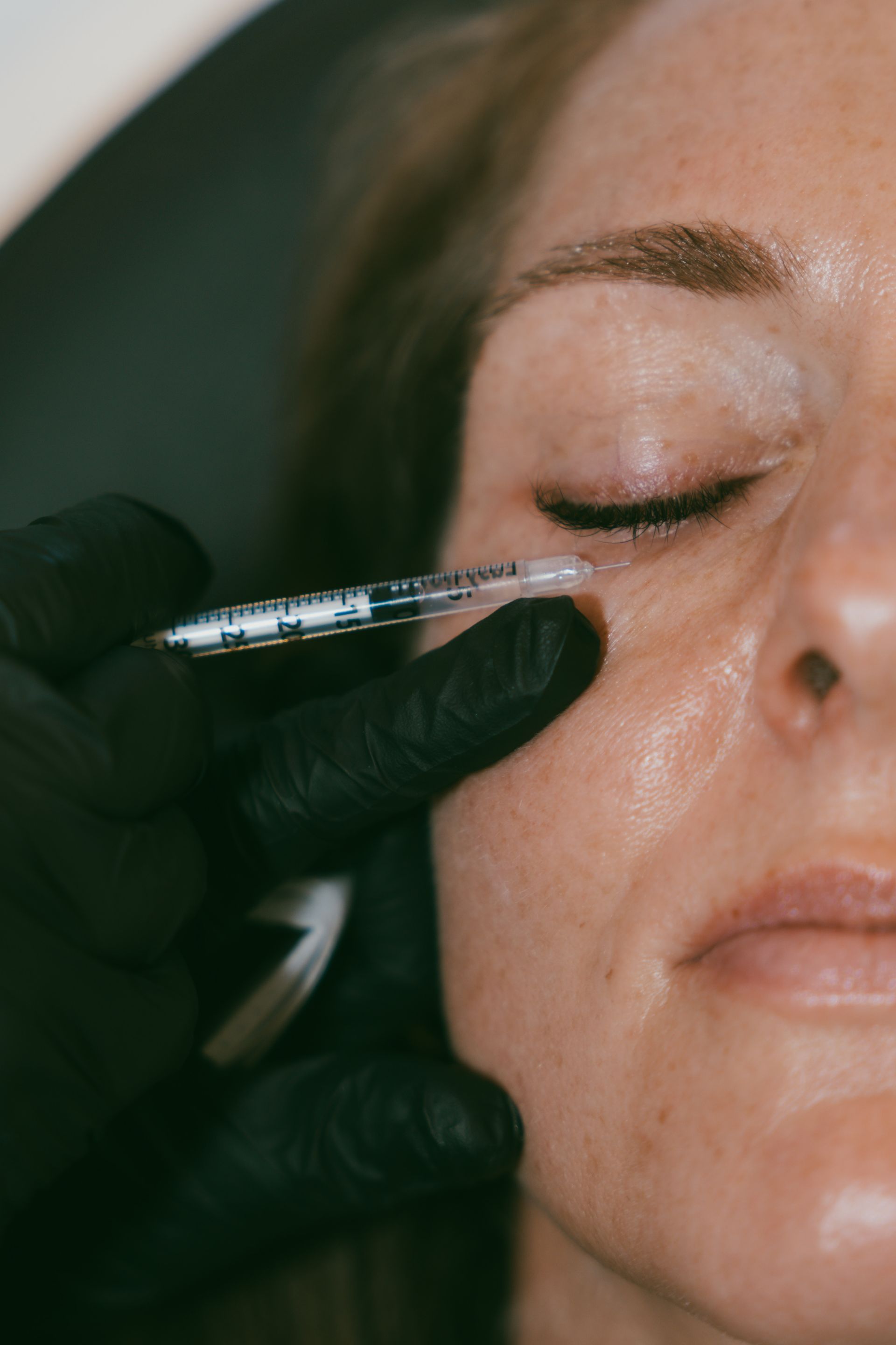 A person's face with a syringe near their eye being held by a gloved hand.