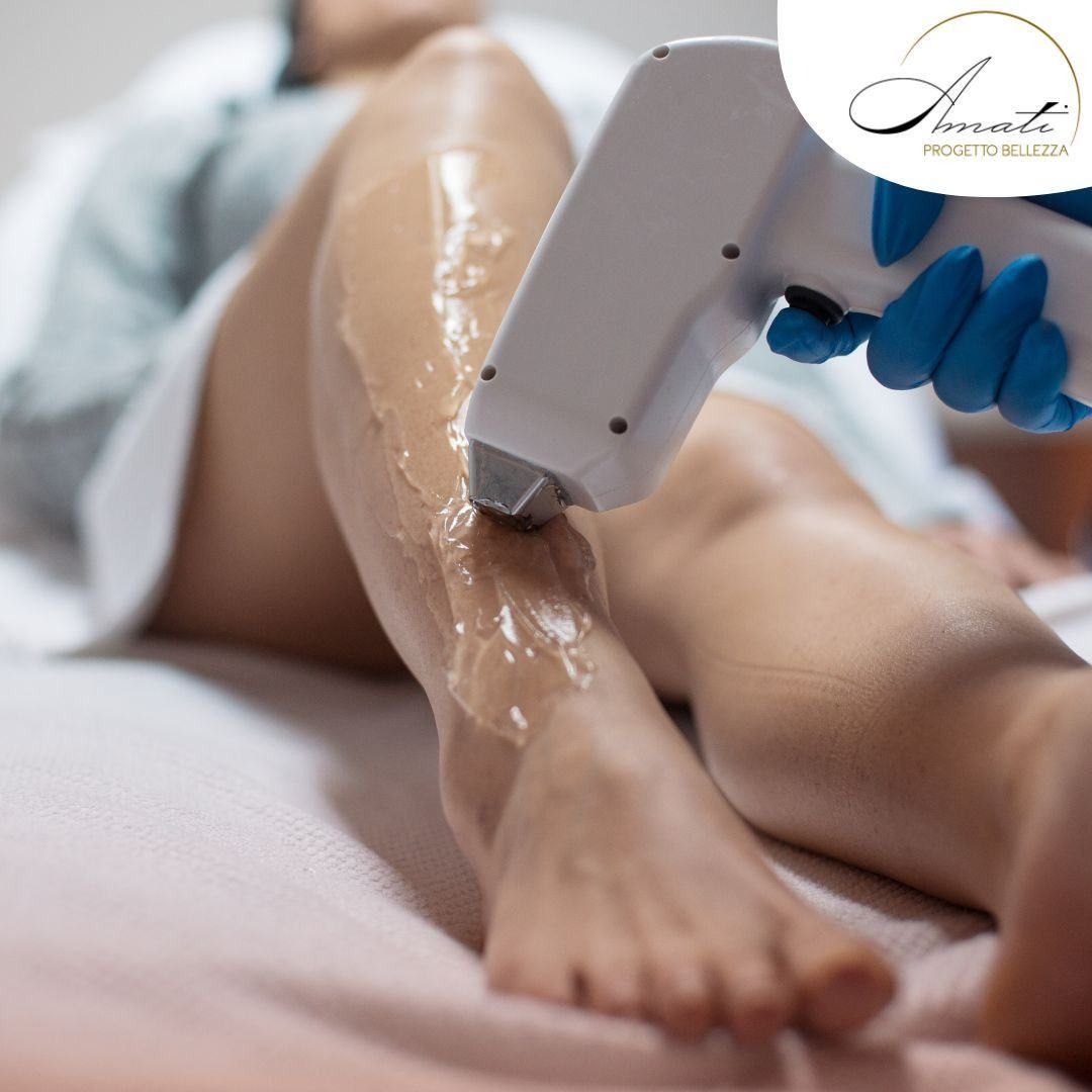 Un medico con indosso guanti blu utilizza un dispositivo laser per la depilazione sulla gamba di una paziente, precedentemente ricoperta di gel trasparente.