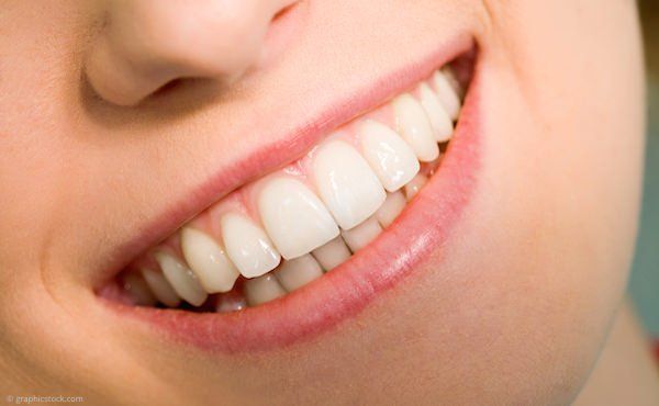 Professionelle Zahnreinigung (PZR) schützt vor Karies, Parodontitis und Mundgeruch.