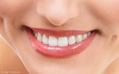 Veneers wurden in Hollywood erfunden Veneers wurden in Hollywood erfunden