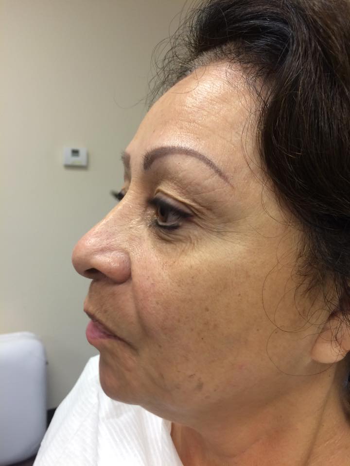 Woman Eyebrows — Woman with New Eyebrows in Worcester, MA