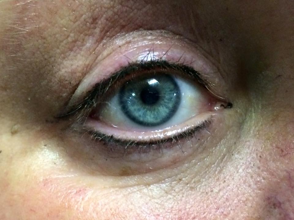 Eye with Eyelashes — Blue Round Eyes with Eyelashes in Worcester, MA