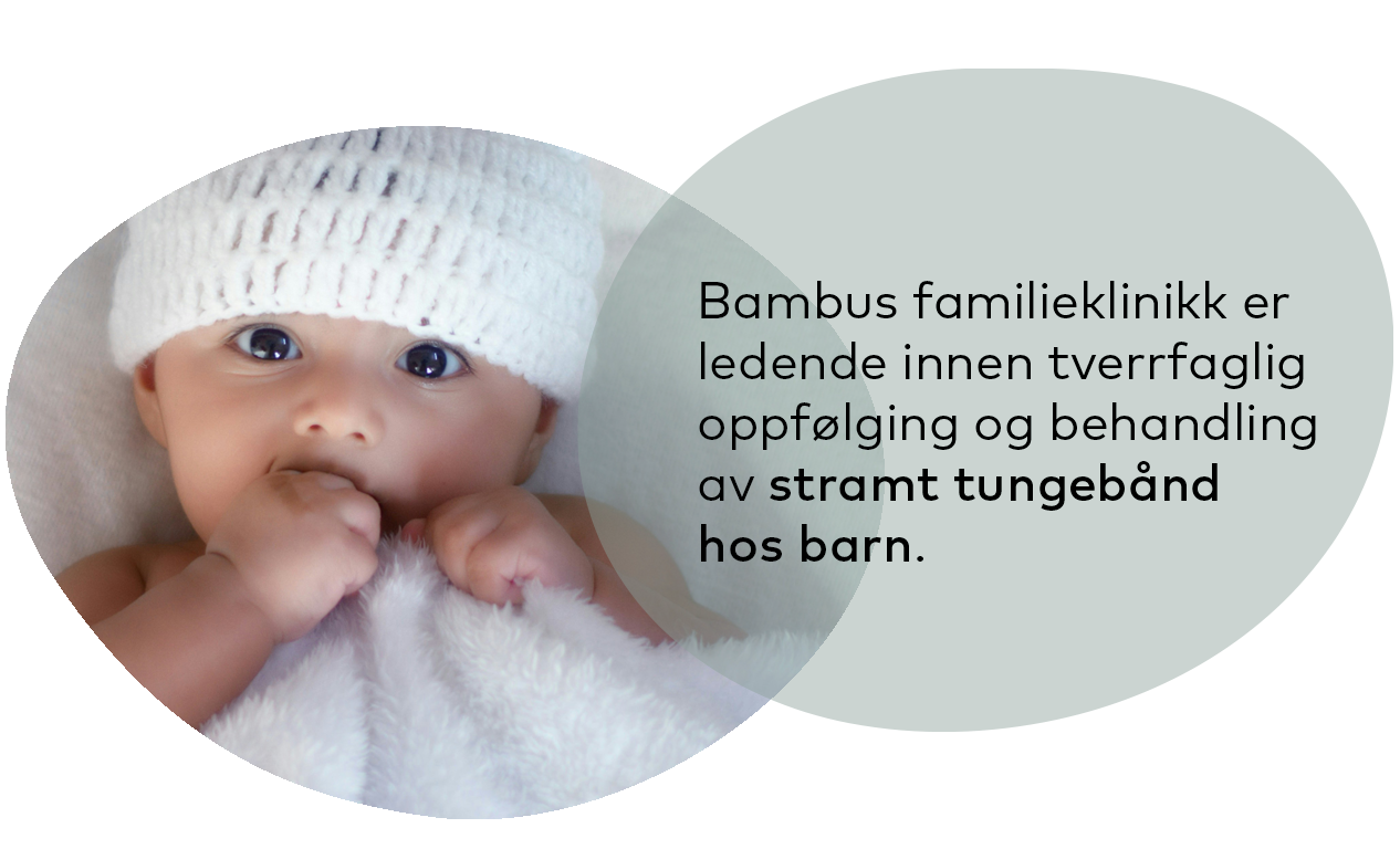 En baby med hvit strikket lue ved siden av tekst om Bambus familieklinikk og behandling for en stram tungebånd.