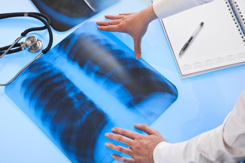 pulmonologist analysing chest X-ray findings
