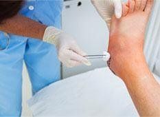 Chirurgia percutanea piede